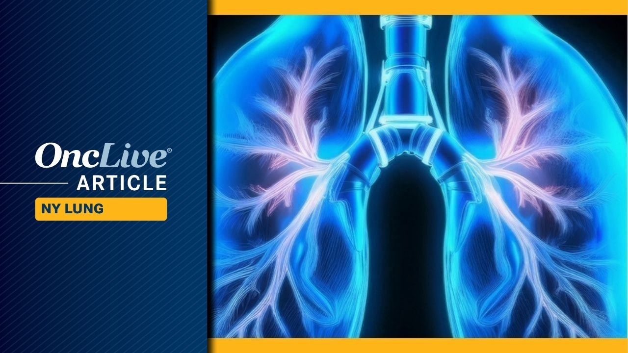 New Biomarkers Revolutionize Non-Small Cell Lung Cancer Treatment